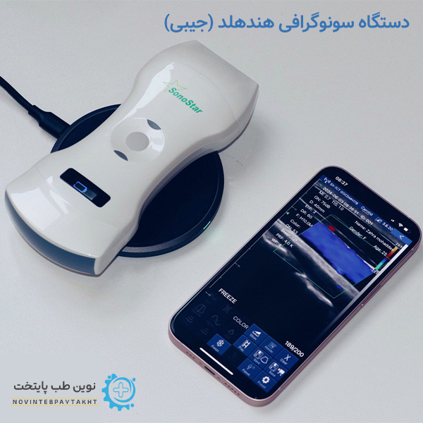 دستگاه سونوگرافی هندهلد (جیبی)